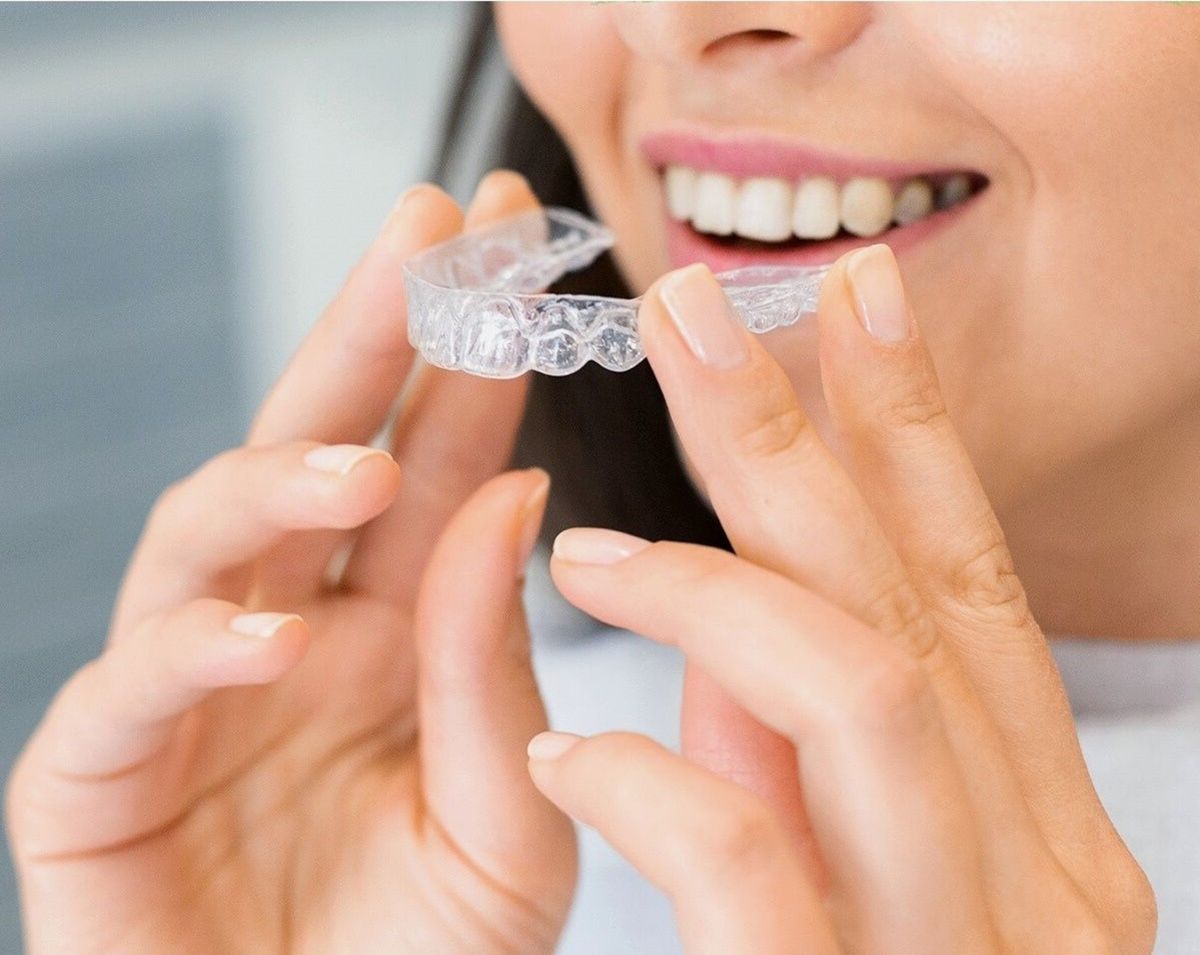 Woman placing a clear Invisalign aligner on her teeth