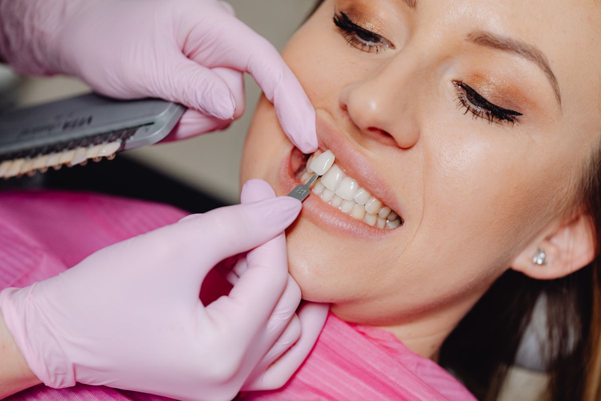 Dentist matching veneer shade to a patient's smile